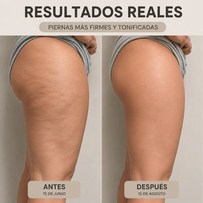 CelluFit™️- Shorts 3D Anticelulíticos y Moldeadores